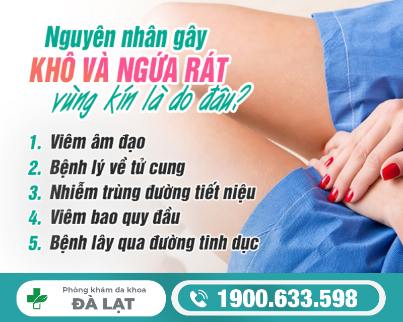 Hình ảnh minh họa